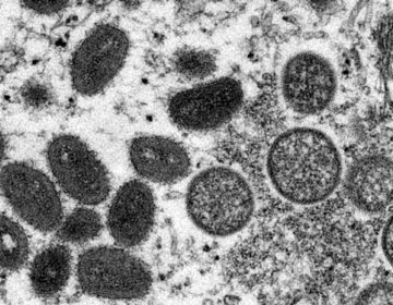 monkey pox in pakistan